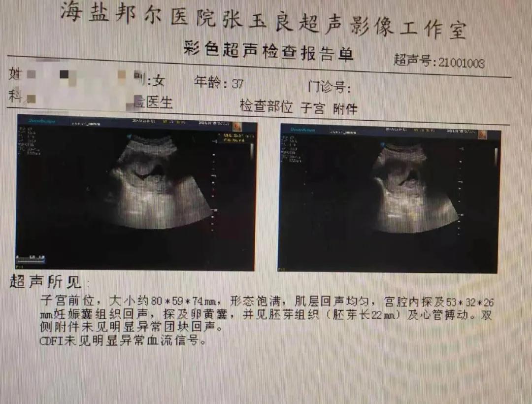 1615864202252093.jpg 微信圖片_20210316110830.jpg